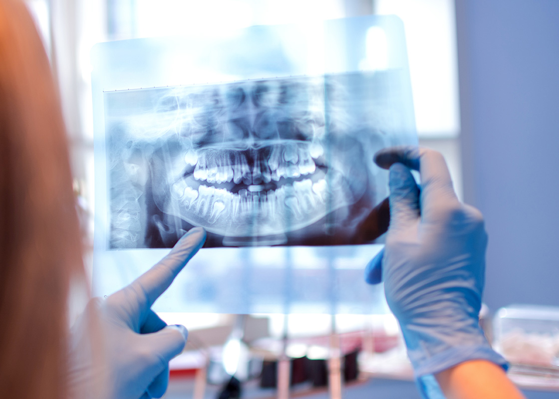 Kiefergelenksbehandlungen im Überblick
